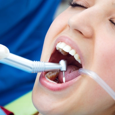 Complete full mouth rehabilitation for total oral health restoration